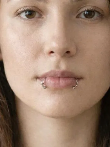 Snake Bites example