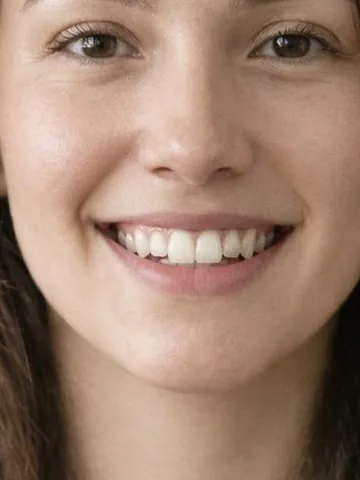 Open Smile example