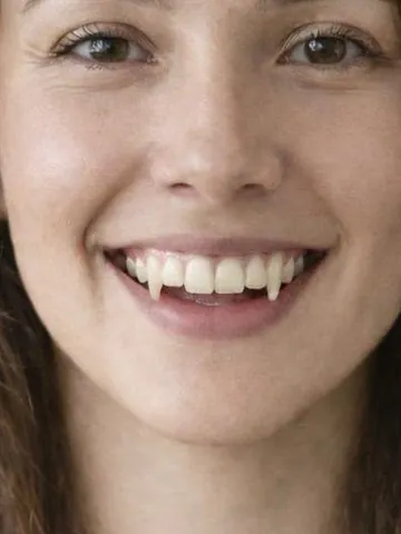 Vampire Fangs example